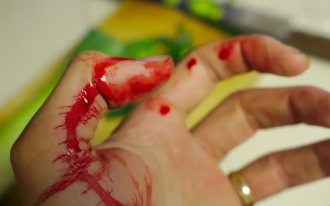 Подробности жестокой семейной драмы в Коми: мать прикрывалась сыном от ударов мужа