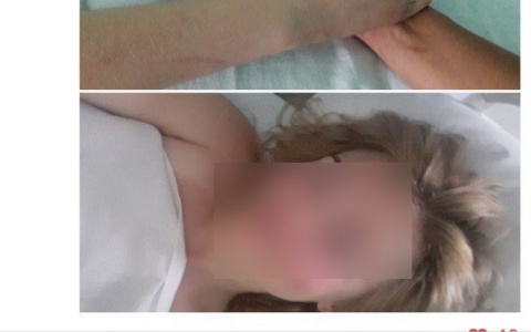 Мама сыктывкарки, которую сбила машина в Питере, вылетела к ней в больницу (фото)