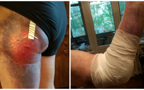 В Сыктывкаре дедушка на роликах получил травмы по вине трех жестоких девушек (фото)