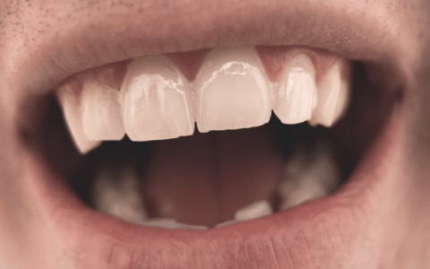 В Коми молодой парень подавился зубным протезом и умер