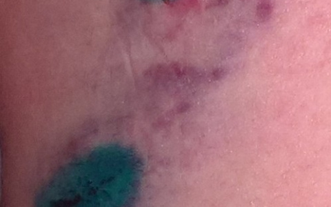 На жительницу Коми набросилась бродячая собака (фото)