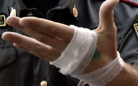 В Коми осудили женщину, которая покусала полицейского