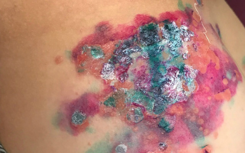 В Минобразе Коми прокомментировали кошмарную поездку мальчика из Сыктывкара в детский лагерь