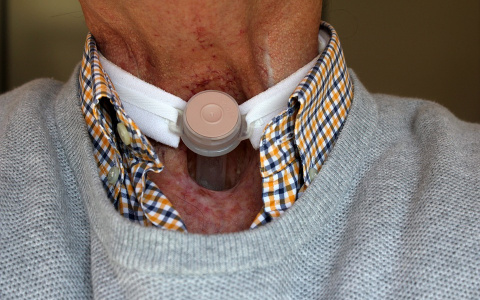 В целом по России смертность от рака снизилась, в Коми - выросла