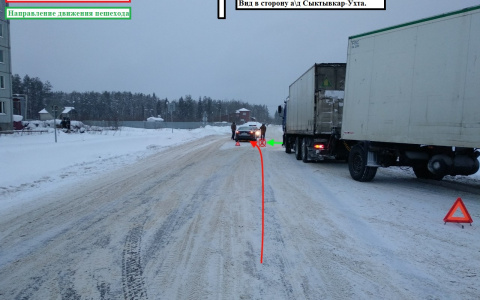 Под Сыктывкаром пенсионерка наплевала на правила и попала под колеса авто