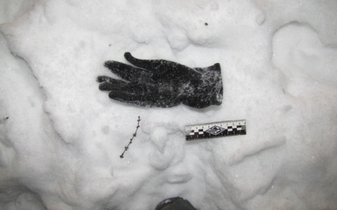 Сыктывкарец, которого покусала пенсионерка, пойдет под суд