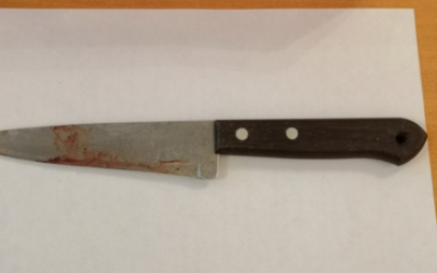 Ревнивый сыктывкарец повздорил с девушкой и снял с нее часть скальпа