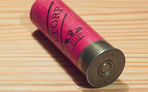 Сыктывкарец почти 30 лет живет с пулевым осколком в ноге