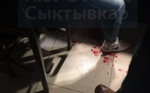 Сыктывкарец: «Парень дал стеклянным стаканом в лицо другому, у него все было в крови»