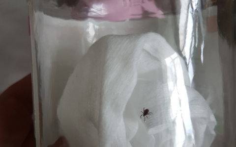 Сыктывкарцы обнаружили на ребенке клеща, когда гуляли на базе отдыха