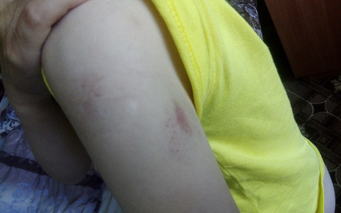 В Коми наглый конь напал на ребенка прямо на улице