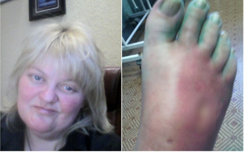 Парень из Сыктывкара собирает деньги, чтобы его матери не ампутировали ноги