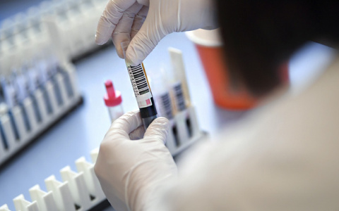 В Коми подтверждены еще 15 случаев заражения коронавирусом