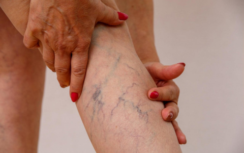 У многих больных коронавирусом есть тромбы