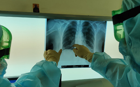 Медиков, которые борются с COVID-19, могут досрочно отправить на пенсию