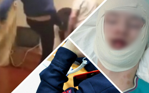 Избиение воркутинца: все что известно о громком уголовном деле