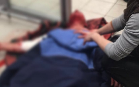 В Ухте свора бродячих собак разорвала женщину и едва не убила мужчину