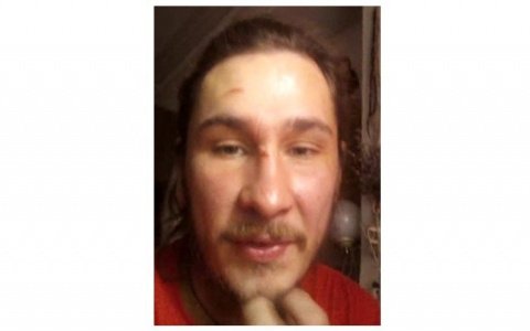 В Коми пропал мужчина с татуировкой и без двух пальцев на руке