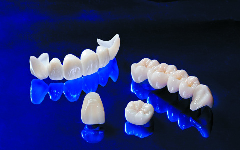 Улыбка дороже золота: сыктывкарский стоматолог рассказал, почему не стоит экономить на коронках