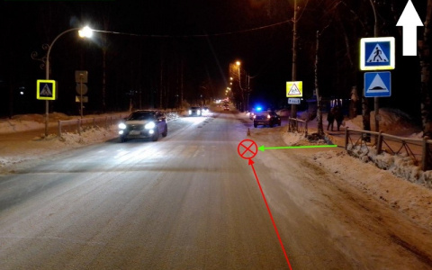 В Сыктывкаре под колеса авто попал 14-летний подросток