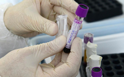 За сутки в Коми умерло 7 пациентов с COVID-19, еще 260 человек заражены