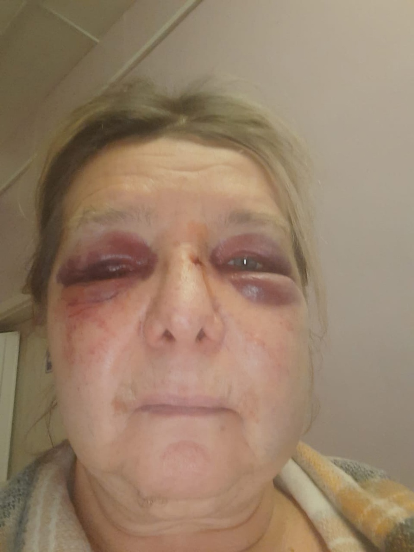 Следователи начали работать с историей об избиении женщины-зоозащитницы в Коми