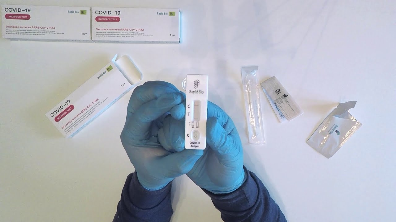 Экспресс-тесты на коронавирус в аптеках Сыктывкара: зачем нужны и сколько стоят
