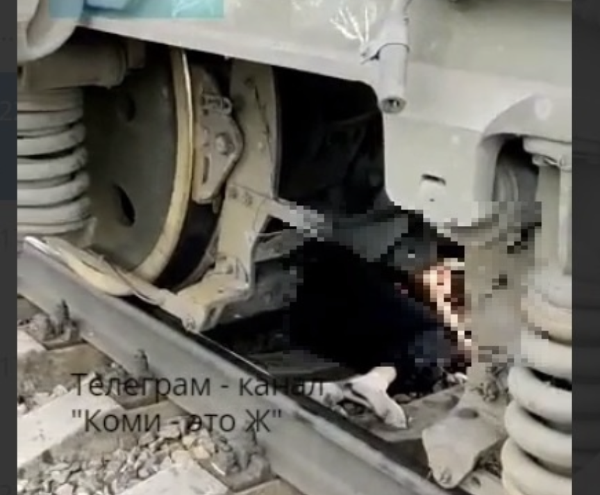 В Сыктывкаре мужчина попал под поезд: сейчас он в реанимации