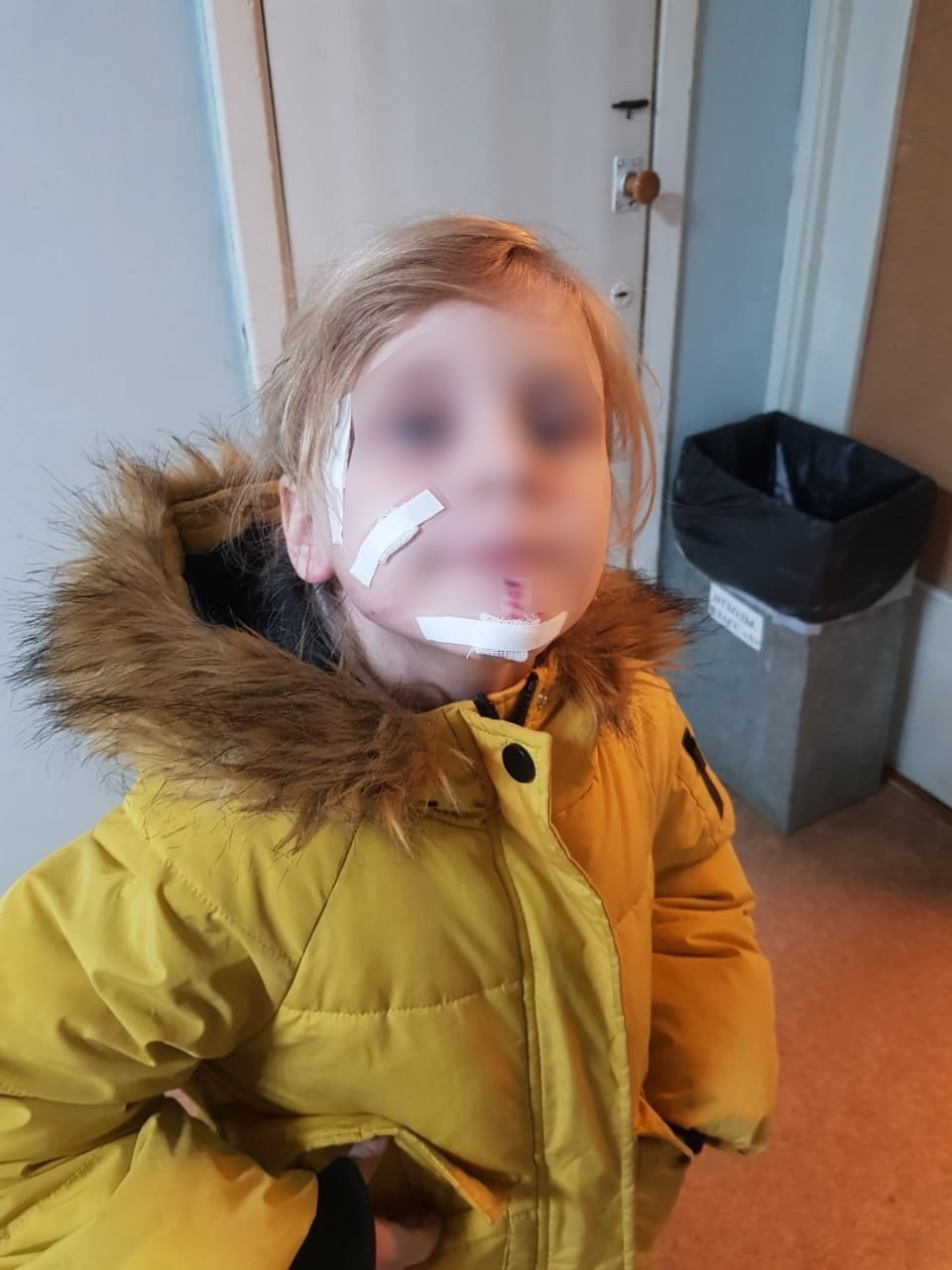 Свора бездомных собак напала на ребенка в поселке под Ухтой