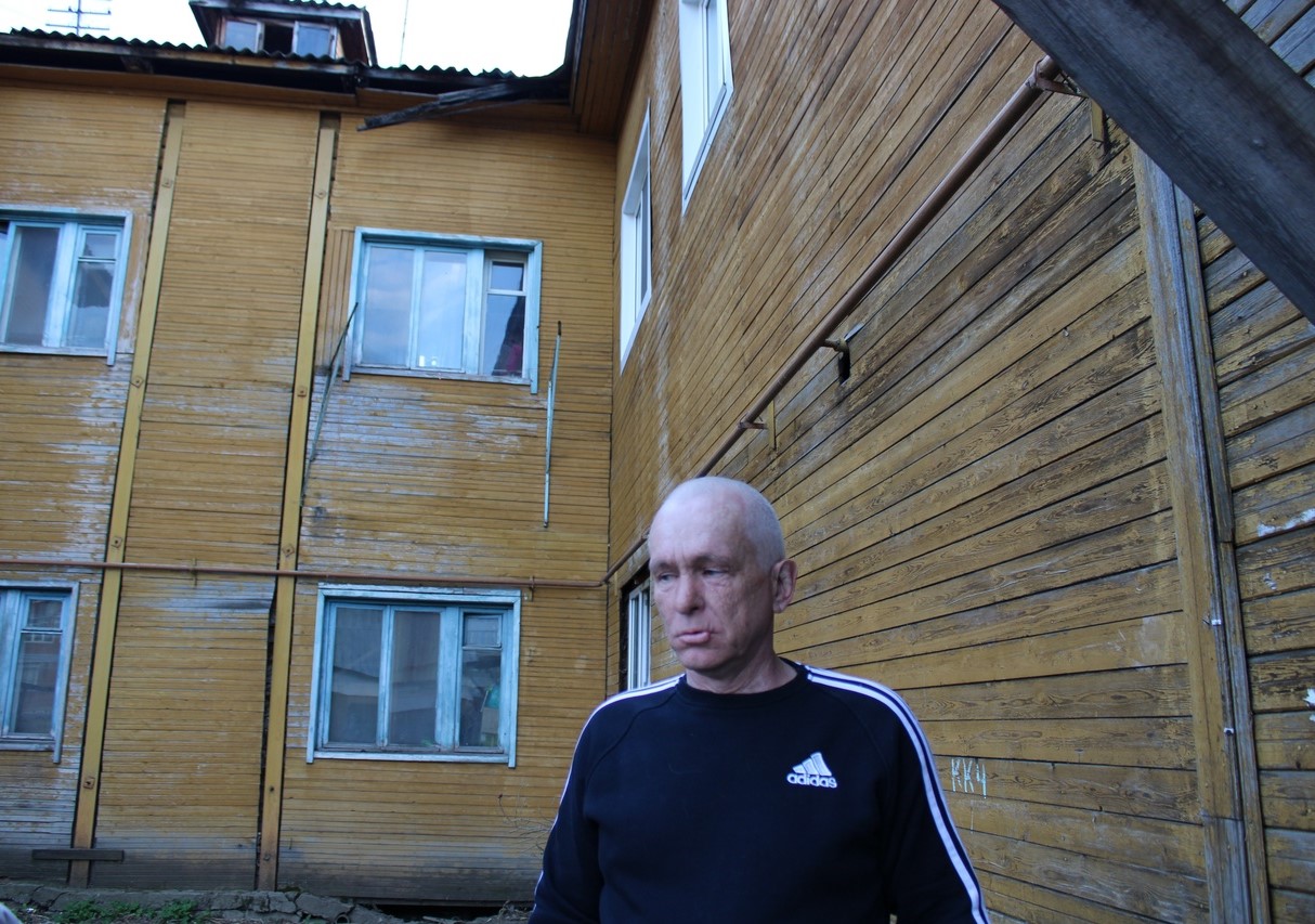 Сыктывкарцы платят 19 тысяч рублей в месяц за дом с разрушенной крышей и дырами в стенах