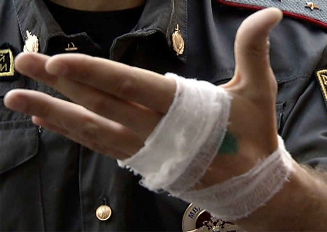 В Коми осудили женщину, которая покусала полицейского