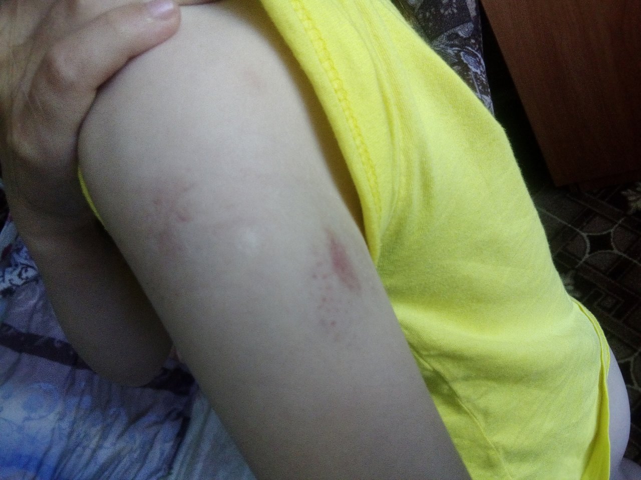 В Коми наглый конь напал на ребенка прямо на улице