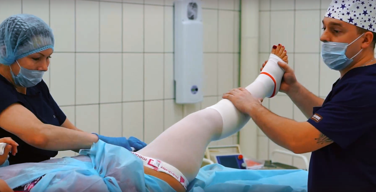 Врач-флеболог о варикозе: можно обойтись без операции