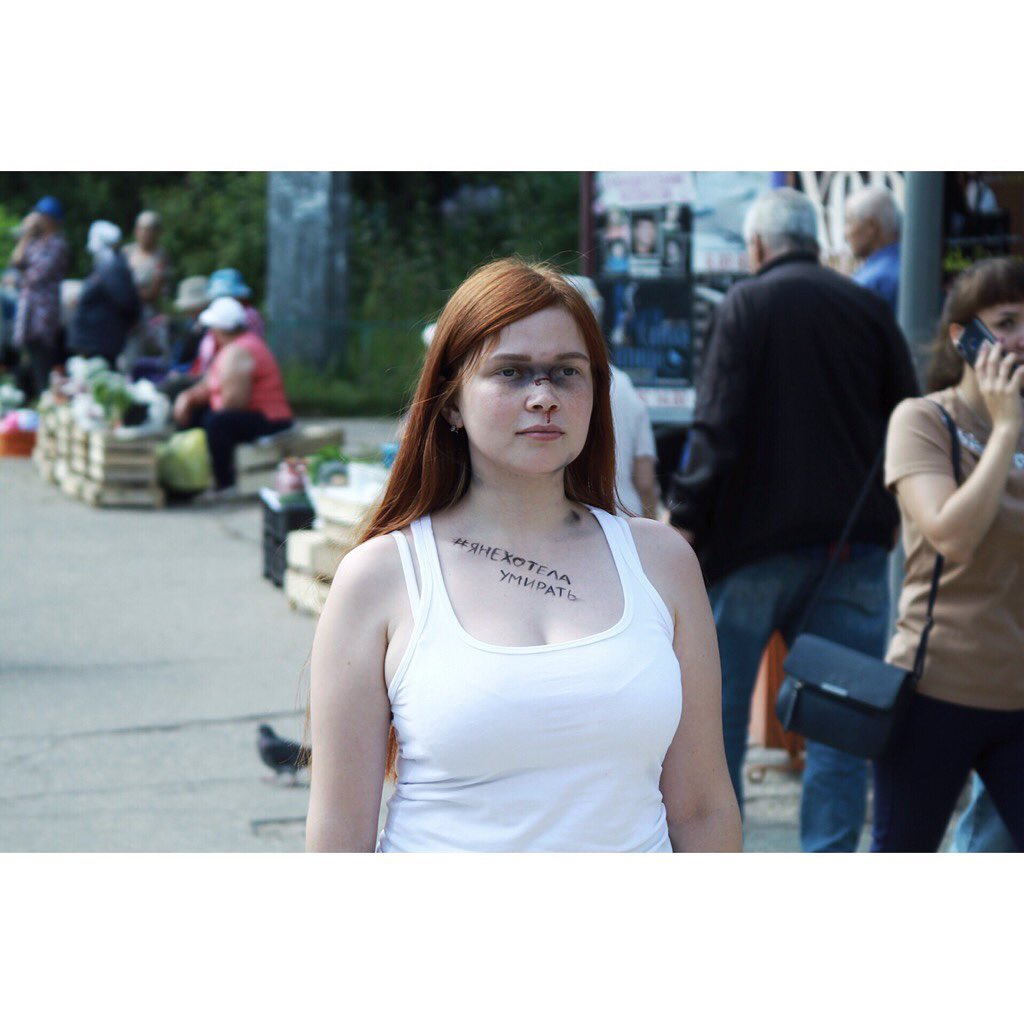 Сыктывкарки с синяками на лице рассказали о побоях в семье (видео)