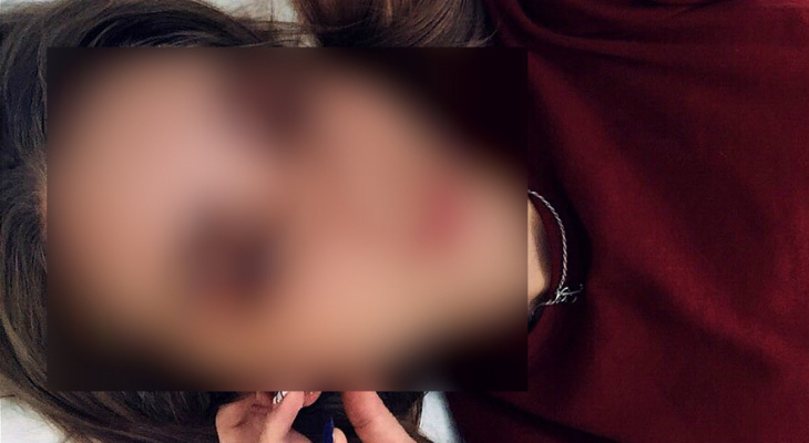 Следователи завершили проверку по факту смерти сыктывкарки за ТРЦ «Июнь»