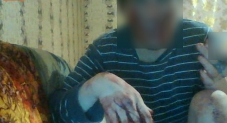 Сыктывкарца, который рассказал об убийстве в прямом эфире, нашли