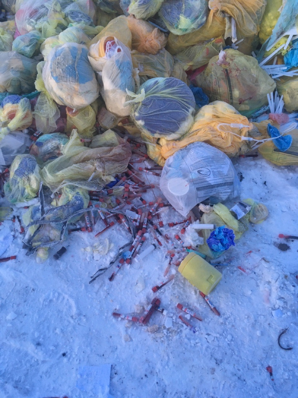 В Коми нашли горы шприцев и кровавых пробирок (фото)