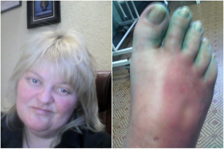 Парень из Сыктывкара собирает деньги, чтобы его матери не ампутировали ноги