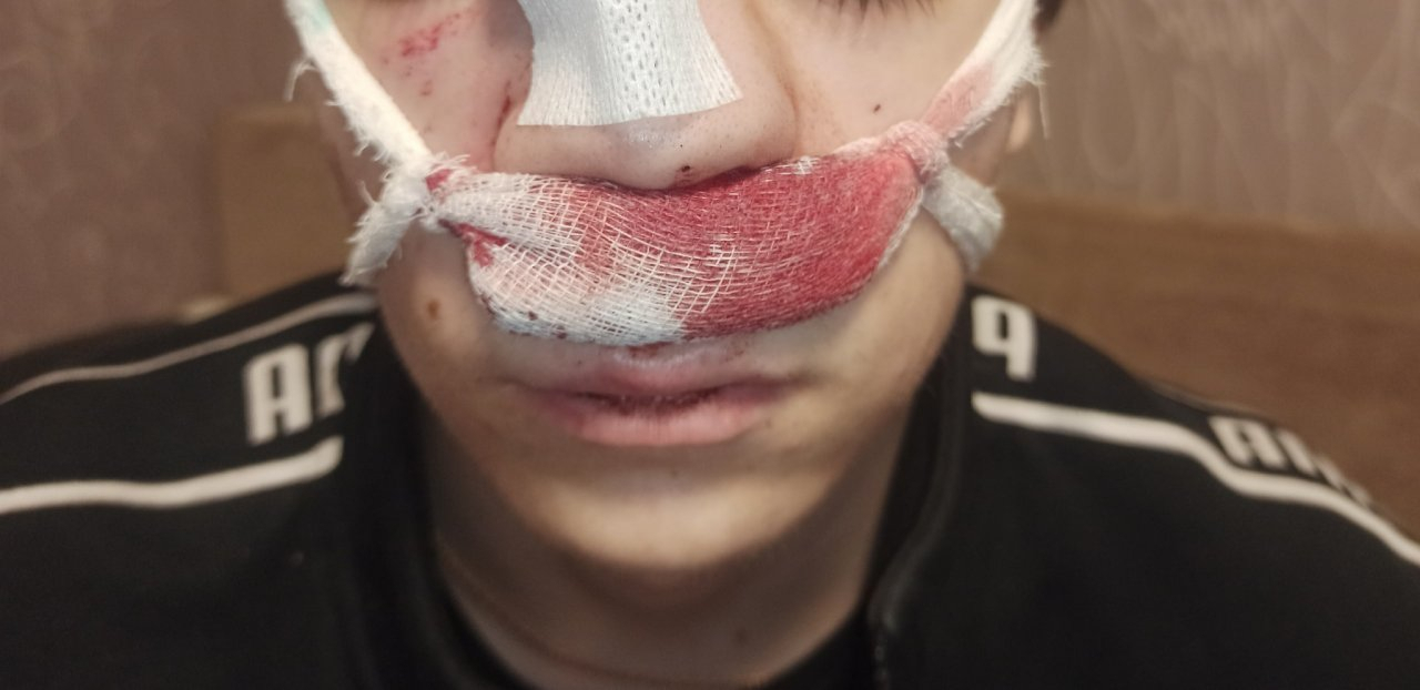 Сыктывкарка: «На студента упала ледяная глыба с крыши СГУ»