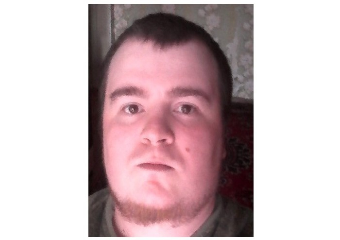 В Сыктывкаре ищут 33-летнего мужчину с родинкой на лице