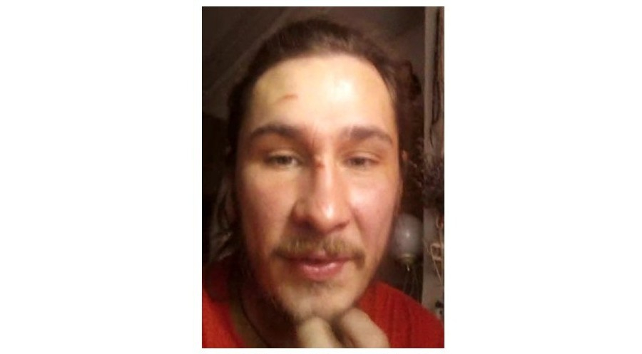 В Коми пропал мужчина с татуировкой и без двух пальцев на руке