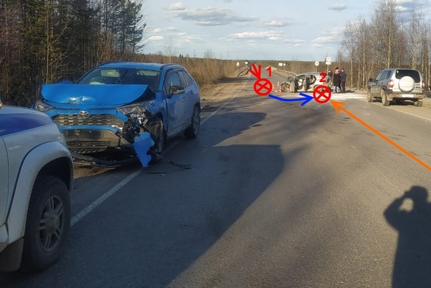 Тройное ДТП в Коми: четыре человека в больнице