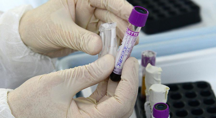 За сутки в Коми умерло 7 пациентов с COVID-19, еще 260 человек заражены